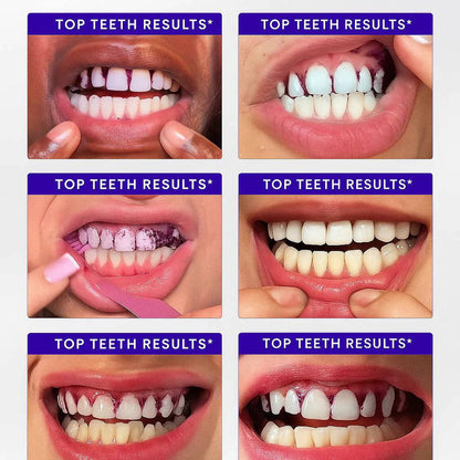 TELYSI Purple Teeth Whitening Strips