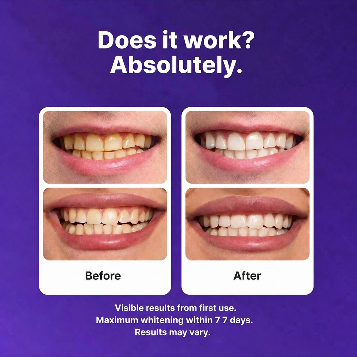 TELYSI Purple Teeth Whitening Strips