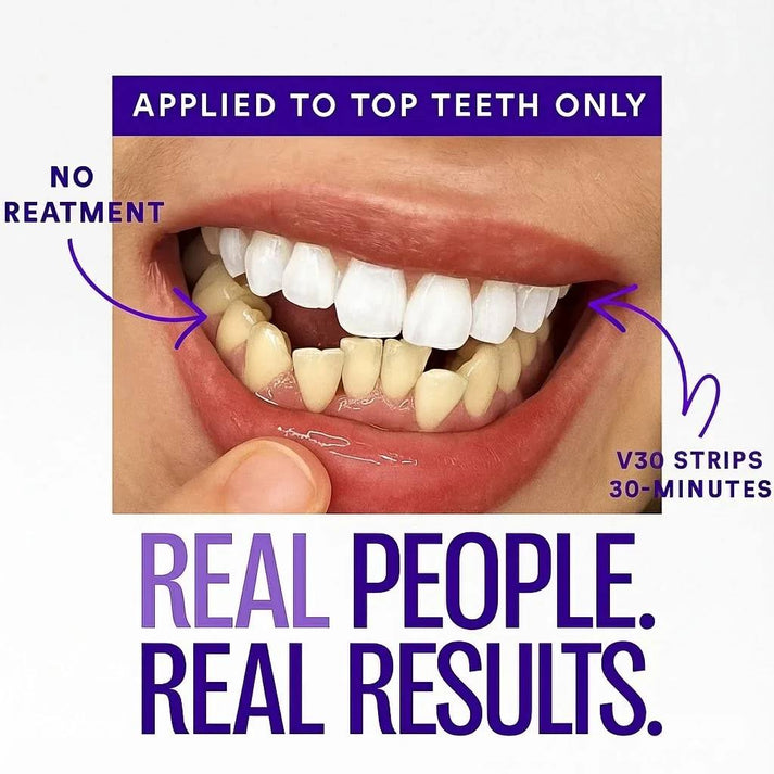 TELYSI Purple Teeth Whitening Strips
