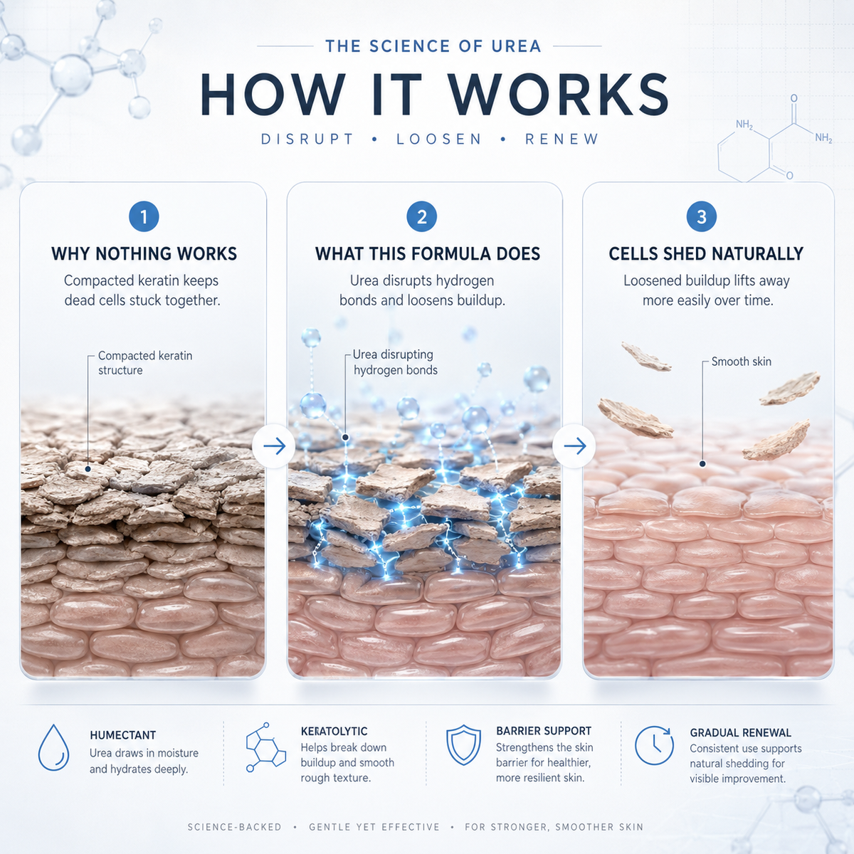 TELYSI — How urea works