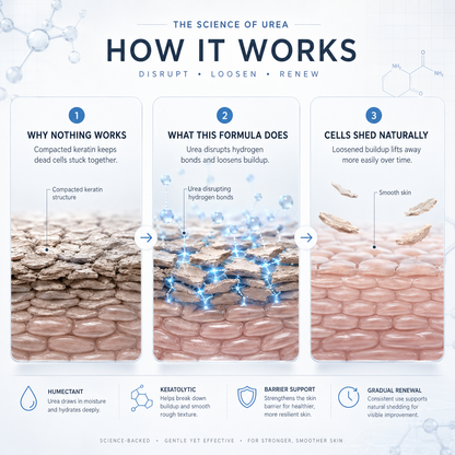 TELYSI — How urea works