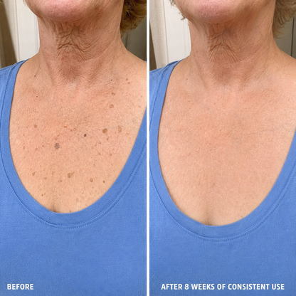 TELYSI — Reference result photograph 3